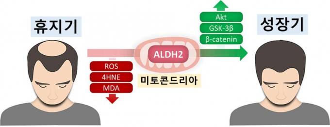 탈모 치료 실마리 찾았다…‘ALDH2’ 활성화해 모발 성장 유도