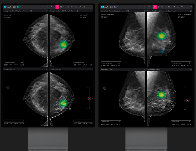 루닛, 美 의료기관에 3D 유방암 검진제품 판매 개시